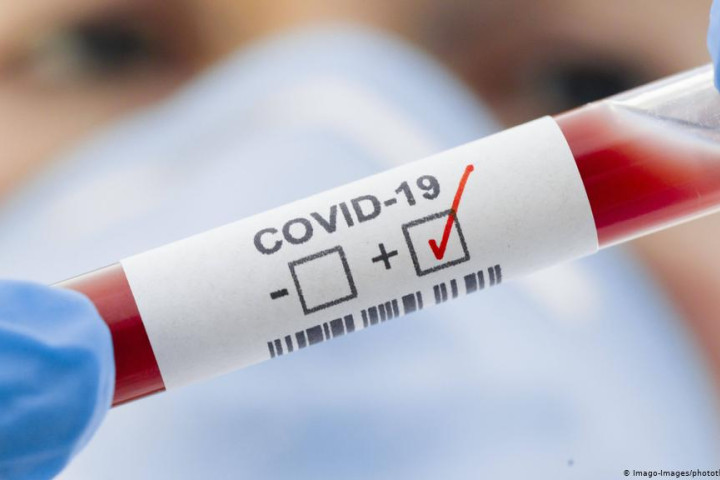 Ученые установили, почему некоторые люди не заболевают COVID-19