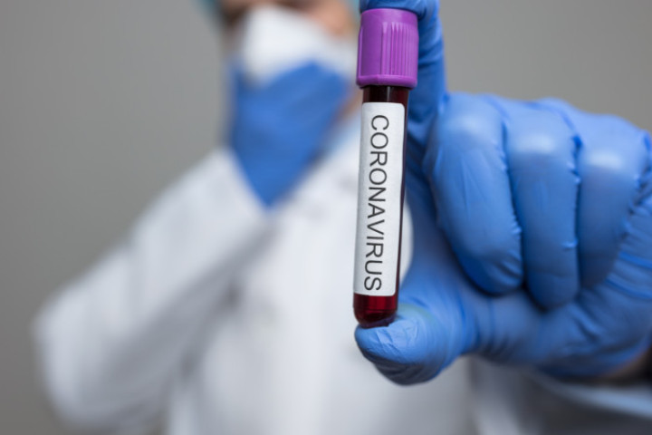 За минувшие сутки в стране был выявлен 221 новый случай COVID-19