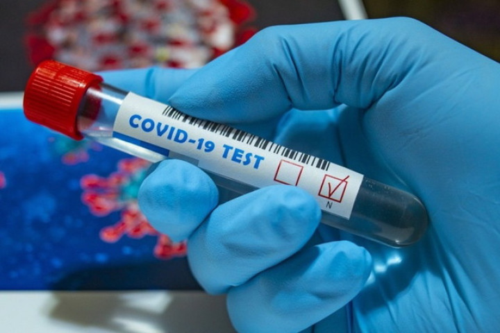 За минувшие сутки в стране было выявлено 292 новых случая COVID-19