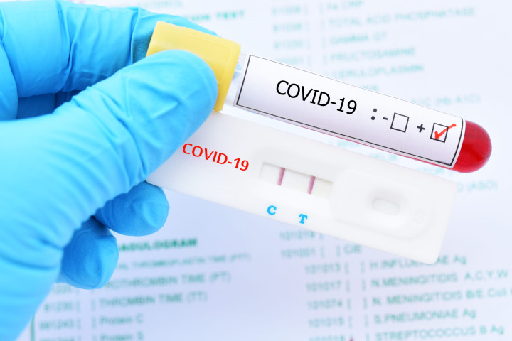 За минувшие сутки в стране было выявлено 305 новых случаев COVID-19