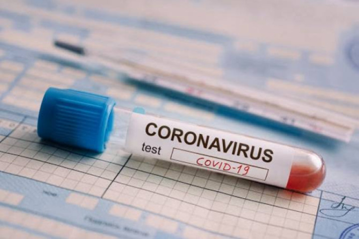 В Узбекистане за сутки выявлены 260 новых больных COVID-19. Четыре человека скончались