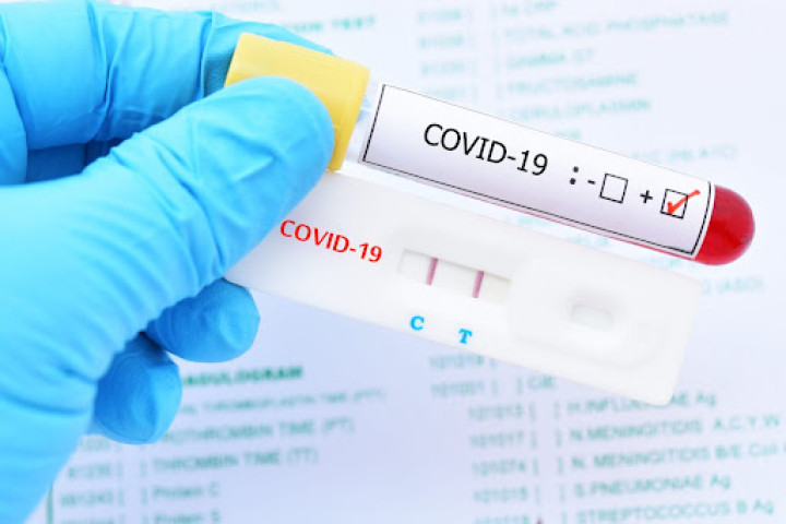 За минувшие сутки в Узбекистане выявлено свыше 300 новых больных COVID-19 и пневмонией