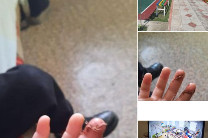 В Фергане 4-летний ребенок в детском саду порезал сверстнику пальцы канцелярским ножом
