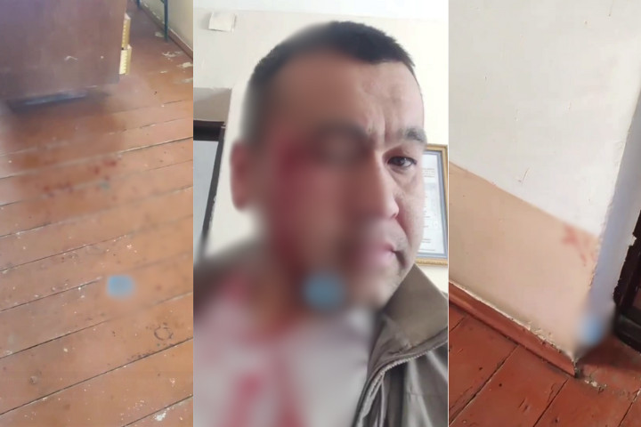 В Фергане родственники ученика избили учителя истории