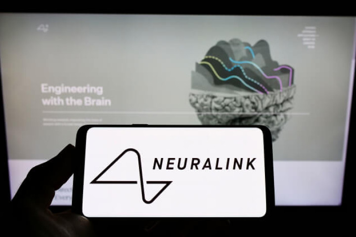 Neuralink впервые имплантировала в мозг человека чип