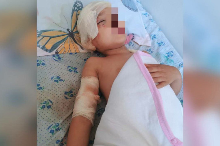 В Андижанской области стая бродячих собак покусала ребенка