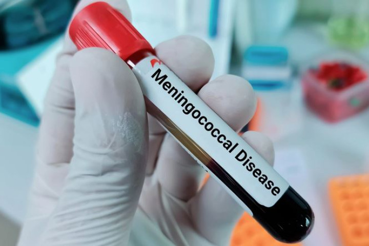 Санэпидком прокомментировал сообщения о менингококковой инфекции