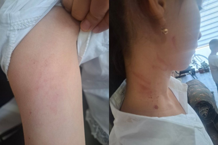 В Сырдарьинской области мать ученицы поцарапала шею ее однокласснице прямо во время занятий
