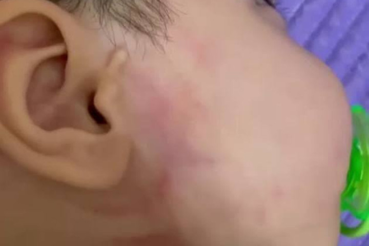 Сотрудник детского сада в Самарканде обвиняется в избиении годовалого ребенка