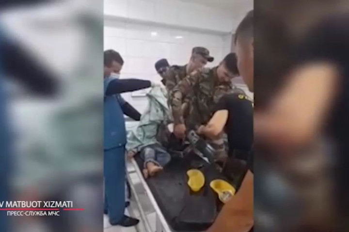 В Намангане эмчеэсники спасли двухлетнего ребенка с застрявшей в мясорубке рукой
