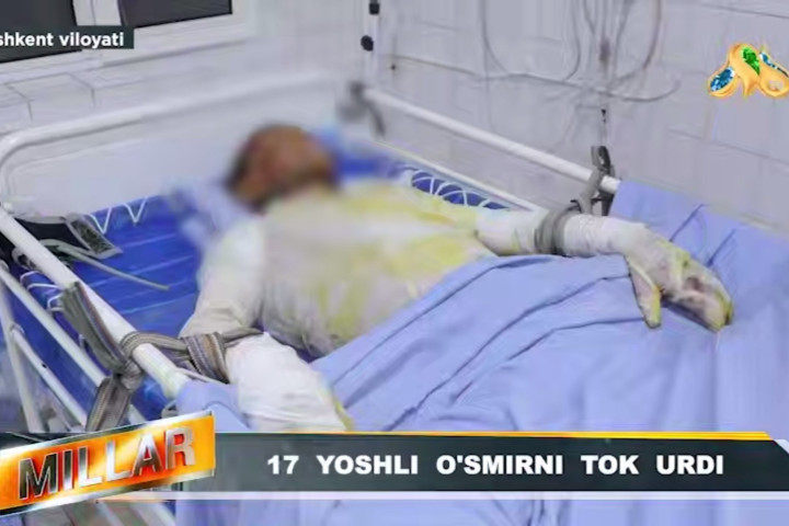 В Ташкентской области подросток пострадал от электричества на крыше вагона