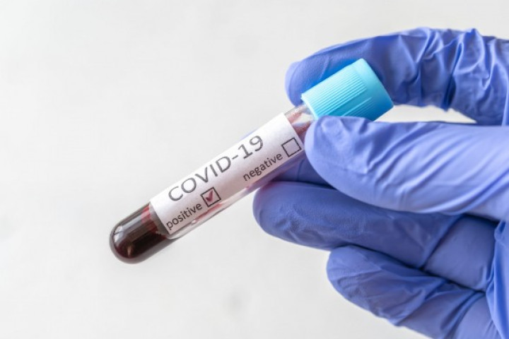 За минувшие сутки в стране было выявлено 342 новых случая COVID-19