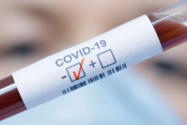 За минувший вторник в Узбекистане выявлено 604 новых случая COVID-19